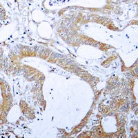 BCLX (Phospho-T47) Rabbit Polyclonal Antibody