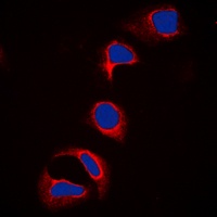 c-CBL (Phospho-Y700) Rabbit Polyclonal Antibody
