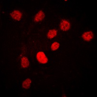 C/EBP beta (Phospho-T235) Rabbit Polyclonal Antibody