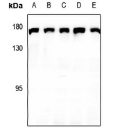 CLASP1 Rabbit Polyclonal Antibody