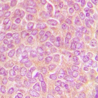 CLASP1 Rabbit Polyclonal Antibody