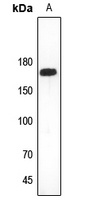 Collagen 11 alpha 2 Rabbit Polyclonal Antibody