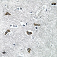 Collagen 11 alpha 2 Rabbit Polyclonal Antibody