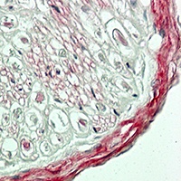 Collagen 4 alpha 2 Rabbit Polyclonal Antibody