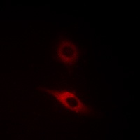 Collagen 4 alpha 2 Rabbit Polyclonal Antibody