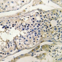 CUBN Rabbit Polyclonal Antibody