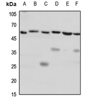 CD184 Rabbit Polyclonal Antibody