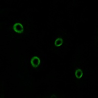 CD184 Rabbit Polyclonal Antibody