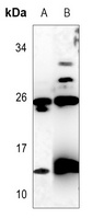 C17 Rabbit Polyclonal Antibody