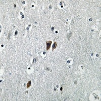 C17 Rabbit Polyclonal Antibody