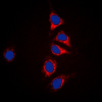 DUSP6 Rabbit Polyclonal Antibody