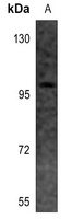 EEF2K Rabbit Polyclonal Antibody