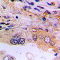 EEF2K Rabbit Polyclonal Antibody