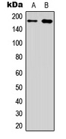 EGFR Rabbit Polyclonal Antibody