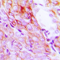 EGFR Rabbit Polyclonal Antibody
