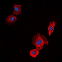 EGFR Rabbit Polyclonal Antibody