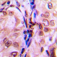 4EBP1 (Phospho-T69) Rabbit Polyclonal Antibody