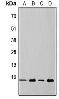 4EBP1 Rabbit Polyclonal Antibody