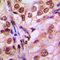 4EBP1 Rabbit Polyclonal Antibody