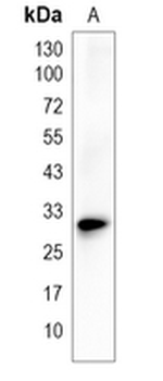 C1QTNF2 Rabbit Monoclonal Antibody