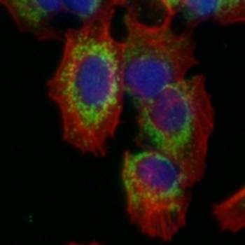 IL-10 Rabbit Monoclonal Antibody