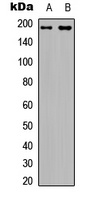 IRS1 (Phospho-S794) Rabbit Polyclonal Antibody