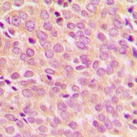 IRS1 (Phospho-S794) Rabbit Polyclonal Antibody