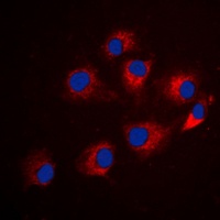 IRS1 (Phospho-S794) Rabbit Polyclonal Antibody