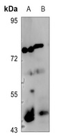 c-Jun (Phospho-S73/100) Rabbit Polyclonal Antibody