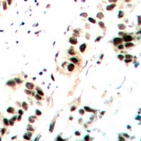 c-Jun (Phospho-S73/100) Rabbit Polyclonal Antibody