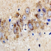 Kir3.1 (Phospho-S185) Rabbit Polyclonal Antibody