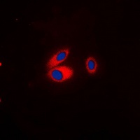 Kir3.1 (Phospho-S185) Rabbit Polyclonal Antibody