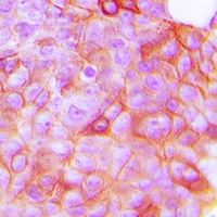 VEGFR2 (Phospho-Y951) Rabbit Polyclonal Antibody