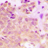Cytokeratin 8 (Phospho-S432) Rabbit Polyclonal Antibody
