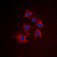 Cytokeratin 8 (Phospho-S432) Rabbit Polyclonal Antibody