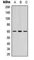 LYN (Phospho-Y397) Rabbit Polyclonal Antibody