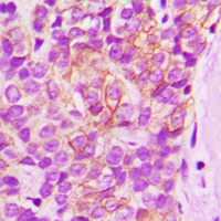 LYN (Phospho-Y397) Rabbit Polyclonal Antibody