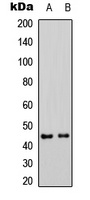 MKK1 (Phospho-S298) Rabbit Polyclonal Antibody