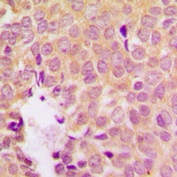 MKK1 (Phospho-S298) Rabbit Polyclonal Antibody