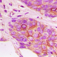 MKK3 (Phospho-T222) Rabbit Polyclonal Antibody