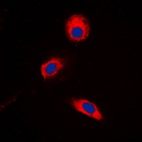 MKK3 (Phospho-T222) Rabbit Polyclonal Antibody