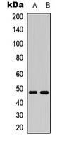 MKK7 (Phospho-S271) Rabbit Polyclonal Antibody