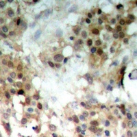 MKK7 (Phospho-S271) Rabbit Polyclonal Antibody