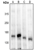 ASK1 (Phospho-S83) Rabbit Polyclonal Antibody