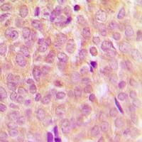 ASK1 (Phospho-S83) Rabbit Polyclonal Antibody