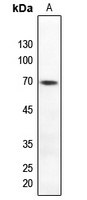 TAK1 (Phospho-T184) Rabbit Polyclonal Antibody