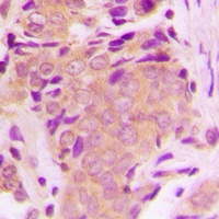 TAK1 (Phospho-T184) Rabbit Polyclonal Antibody