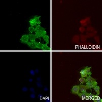 TAK1 (Phospho-T184) Rabbit Polyclonal Antibody
