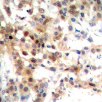 p38 Rabbit Polyclonal Antibody
