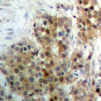 ERK7 (Phospho-T175/Y177) Rabbit Polyclonal Antibody
